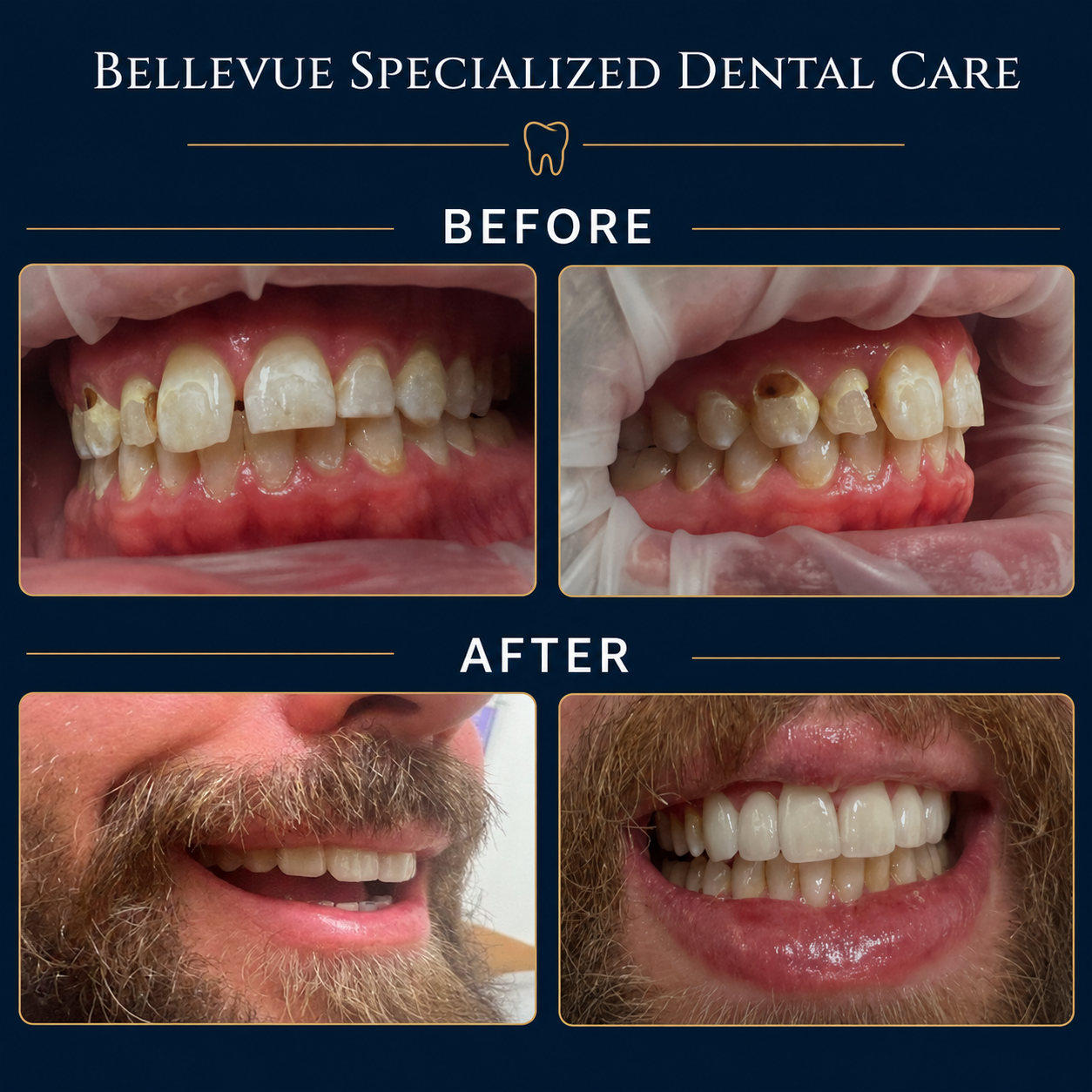 Before and After 2