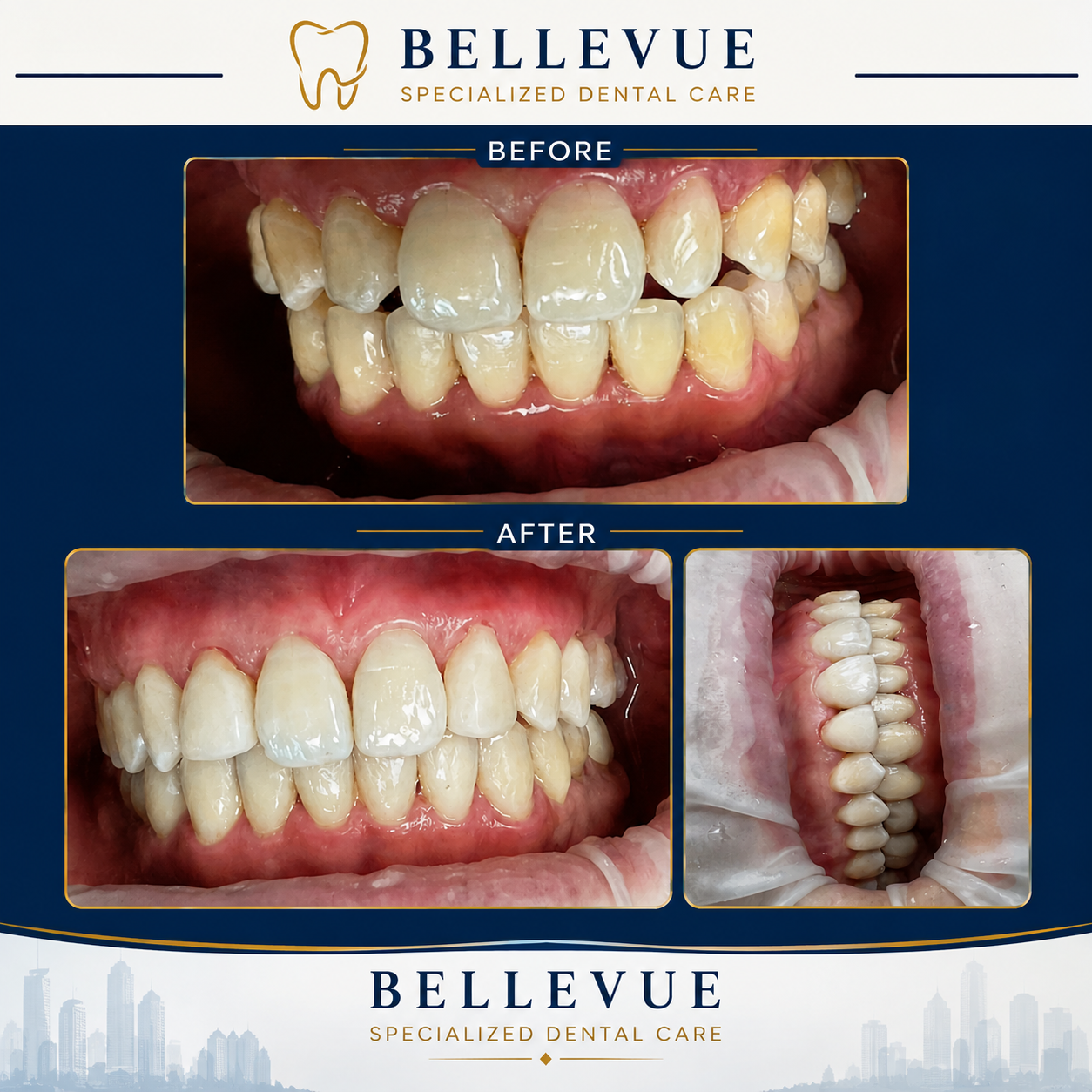 Before and after 3