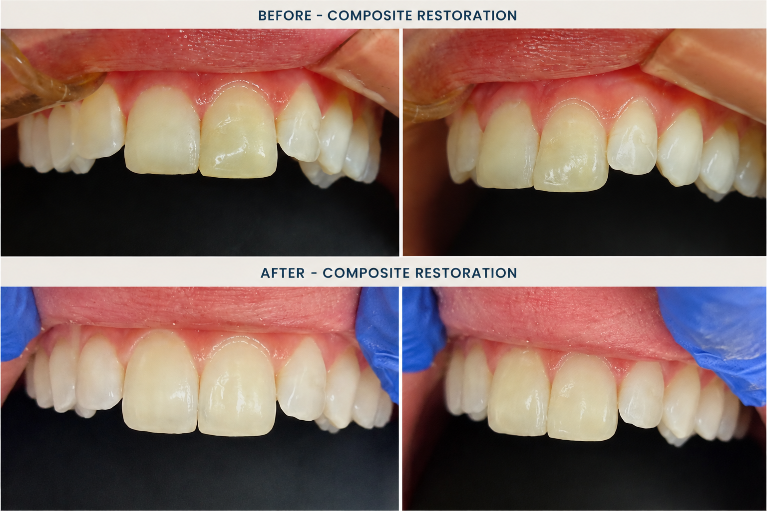 Before and after1