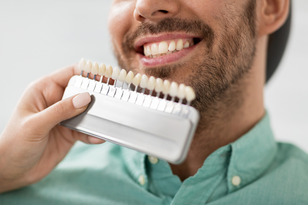 Dental Veneers Bellevue